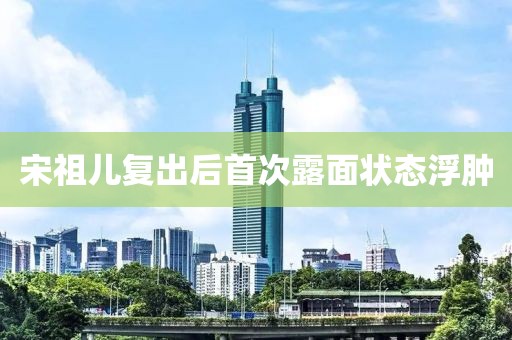 宋祖儿复出后首次露面状态浮肿